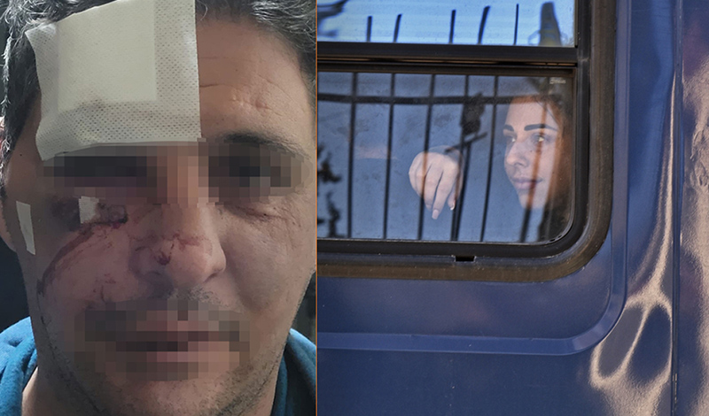 super kiki 37xronos arthro