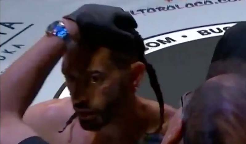 traumatismos bkfc 35