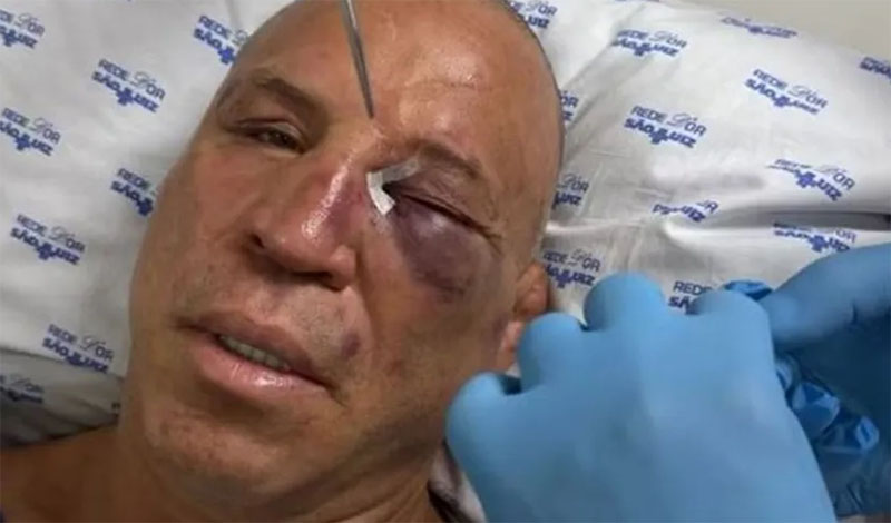 wanderlei silva nosokomeio